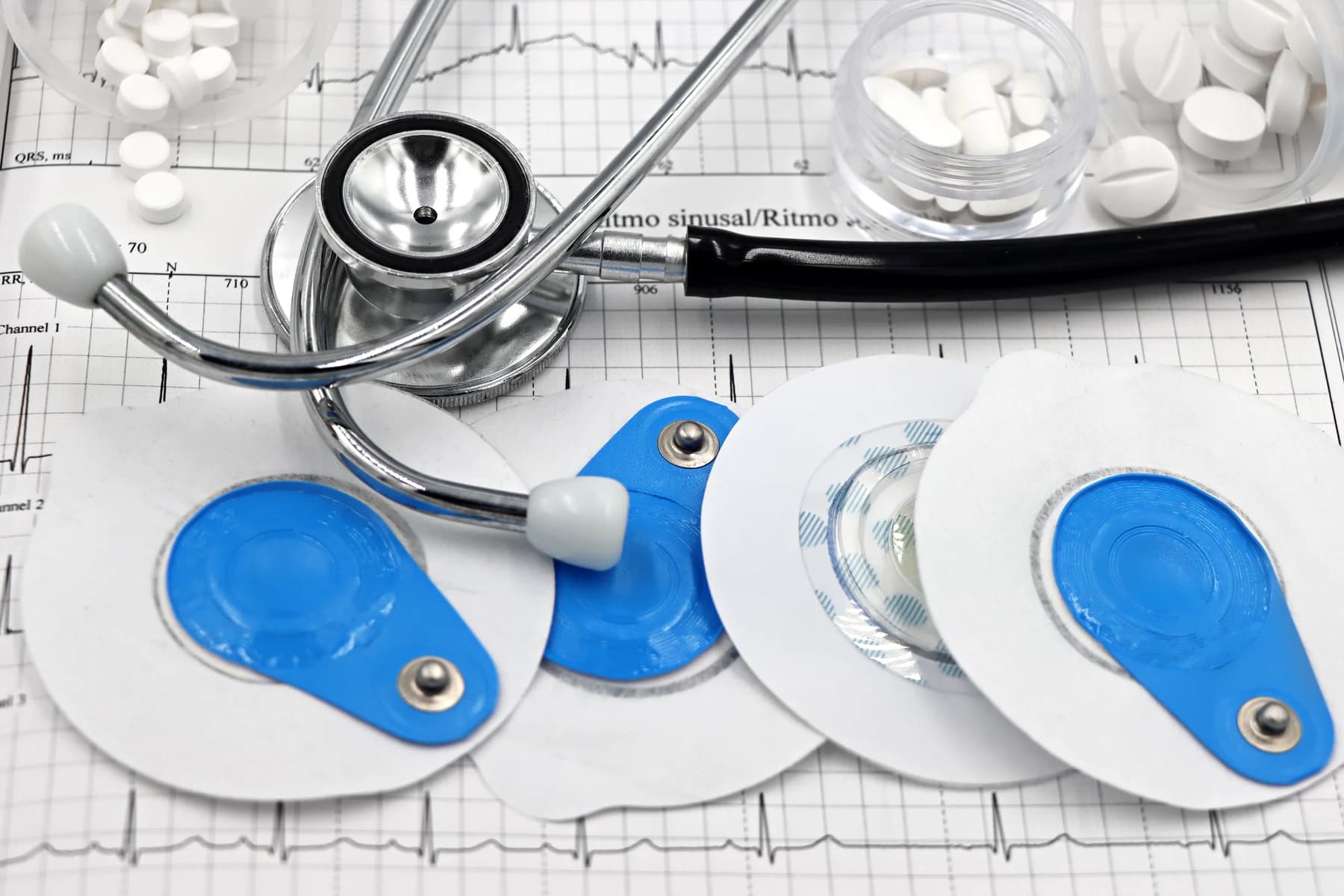 A stethoscope, blue electrode pads and medical supplies on ECG paper.